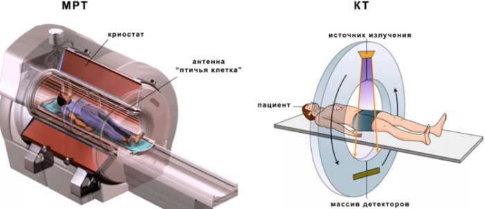 опасность при мрт и кт